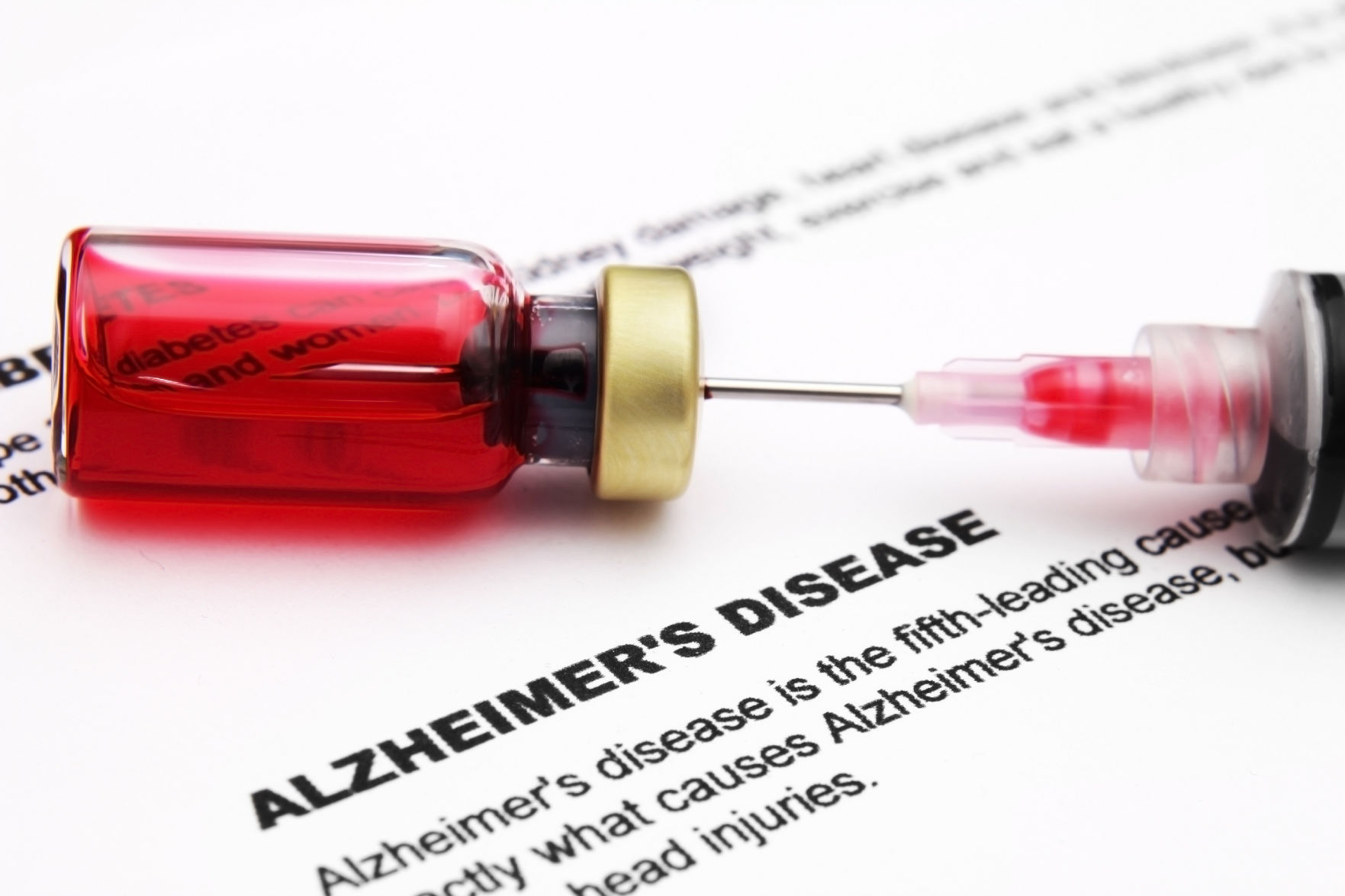 Alzheimer disease